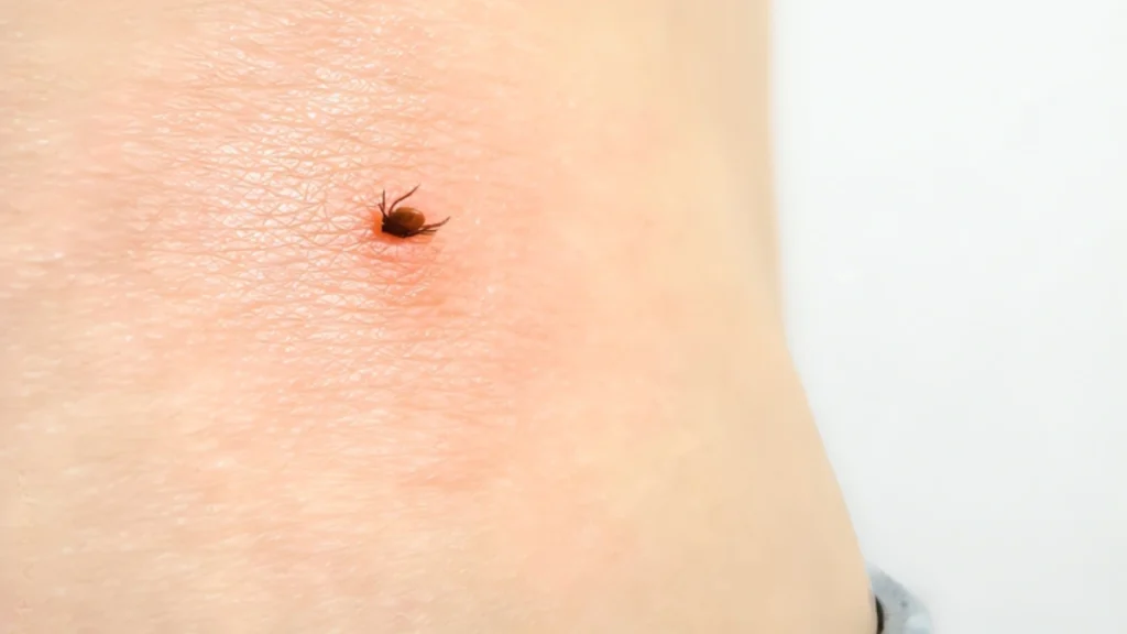 What part of the castor bean plant is poisonous 